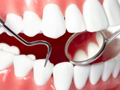 What Is Considered Good Oral Hygiene and How to Maintain It