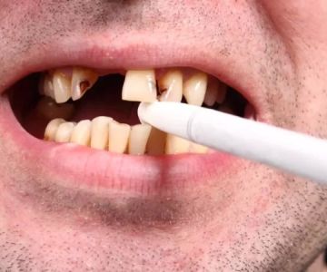 Oral Health Tips for Smokers: Practical Ways to Protect Your Smile