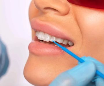 How to Reduce Teeth Staining from Smoking – Effective Whitening and Prevention Tips