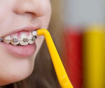 Oral Hygiene Tips for Children with Braces