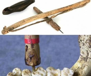 How Did Ancient People Keep Oral Hygiene – Early Dental Care and Natural Remedies