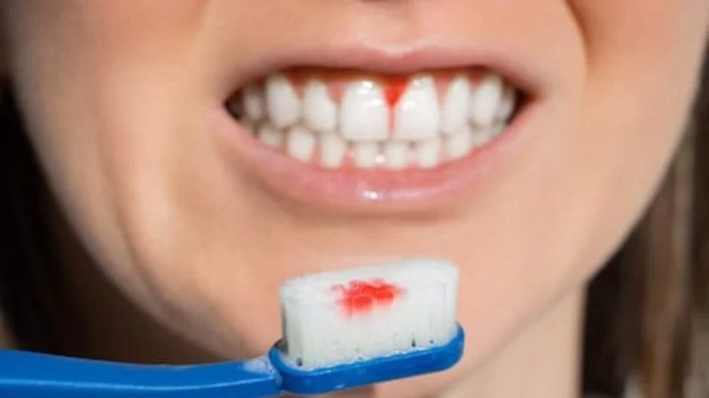 What Are the Effects of Poor Oral Hygiene on Your Health