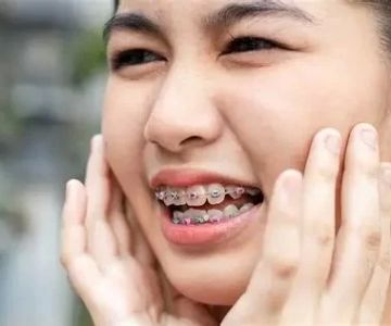 Best Dental Care Routine for Braces for Healthy Teeth