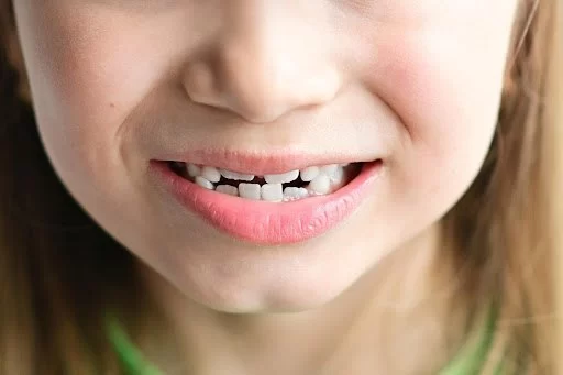 How to Recognize Jaw or Bite Alignment Issues in Children Early