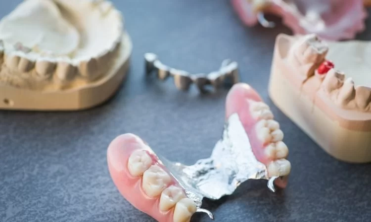 Are Partial Dentures a Good Alternative to Implants? Pros and Cons
