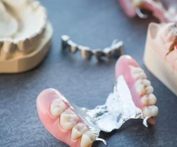Are Partial Dentures a Good Alternative to Implants? Pros and Cons