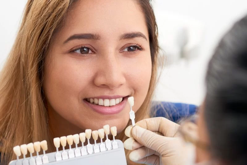 How to Choose the Right Shade for Dental Veneers or Crowns