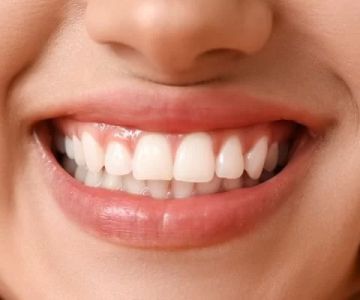 How to Keep Your Gums Healthy During Hormonal Surges (Teenage Years, Menopause, Etc.)