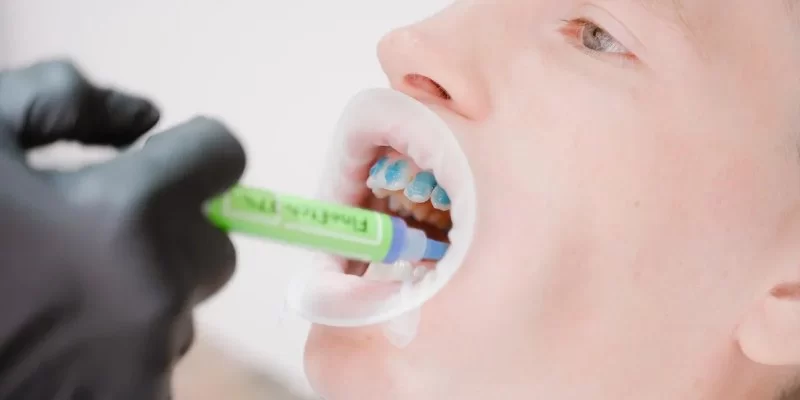 The Benefits of Fluoride for Children’s Teeth: Essential for Healthy Smiles