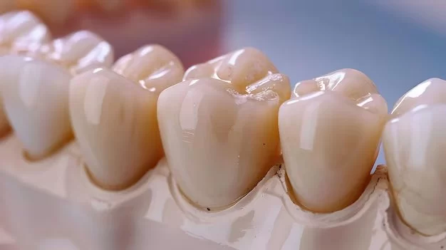 What Are Dental Crowns and How They Help Restore Your Teeth?