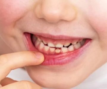 How to Handle a Loose Tooth in Children: A Parent’s Guide to Managing the Situation