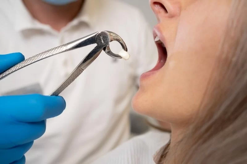 Wisdom Teeth Removal for Patients with Diabetes: How to Choose the Right Approach