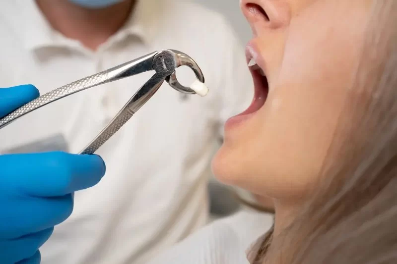 Should You See a Dentist Immediately? The Complete Guide to Tooth Extraction