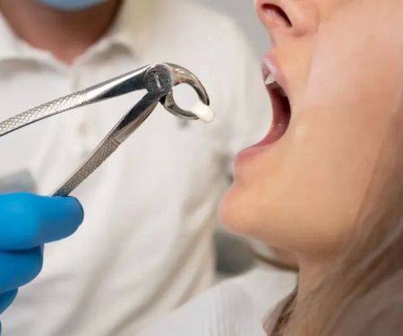 Should You See a Dentist Immediately? The Complete Guide to Tooth Extraction